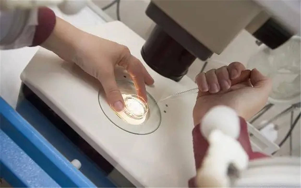 孕酮