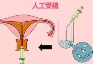 孕妇通便润肠小妙招