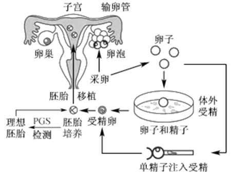 孕期瑜伽