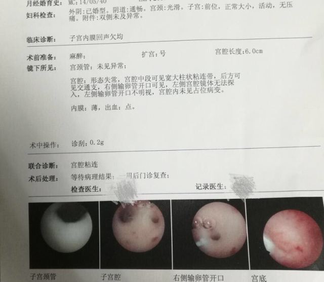 孕期胎儿大小