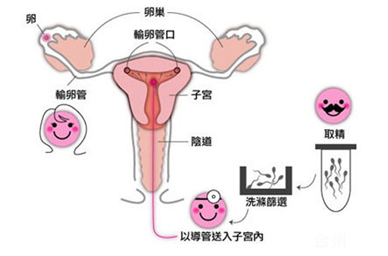 孕早期饮酒