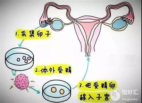 孕期